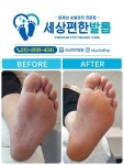 세상편한발톱