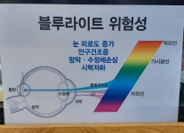 안경홀릭