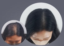 일루젼스칼프 제이든