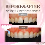 바른길치과의원 대전