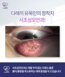 서초성모안과의원