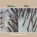 오늘도스무살 두피&헤드스파 사하구점