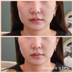 보니또 스킨앤바디
