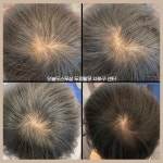 오늘도스무살 두피&헤드스파 사하구점