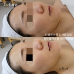 더맑은스킨 안산중앙점
