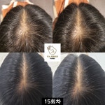 도노포레스타 두피케어 산본점