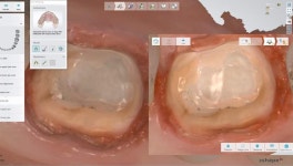 큰숲L 디지털치과기공소