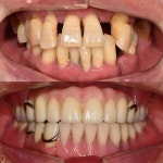 큰숲L 디지털치과기공소