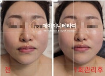 제이지니테라피