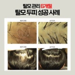 헤솔 두피클리닉스 롯데부산광복점