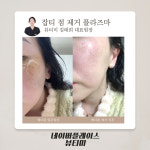 천안뷰티미 왁싱피부 토탈성정점