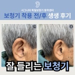 시그니아 독일보청기 동작센터