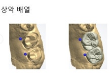 월드베스트디지털치과기공소