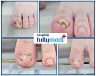 동성풀리메디 대전본부센터점