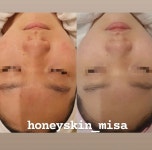 허니스킨