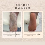 레푸스 화서역점 풋케어 발톱 발각질 문제성 발관리전문점