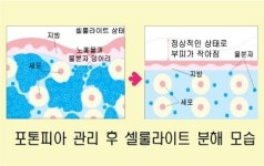 미니닷 광주수완점
