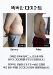 광교PT&재활 피지오엘운동센터