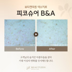 뷰티젠의원 위례
