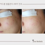 세렌에스테틱