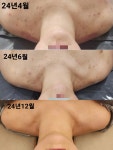 텐비엔뷰티랩 | 아이앤비뷰티랩