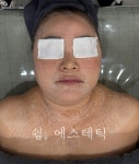 쉼,에스테틱