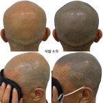 림스칼프 대구본점