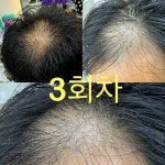 브이힐링헤어두피모발전문샵 | V힐링헤어두피모발전문샵