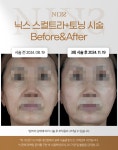 닉스의원 대전