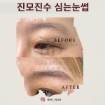 천안왁싱 뷰티앤케이