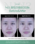 닉스의원 대전