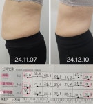 이뮨팩토리 온빛