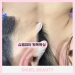 슈엘뷰티