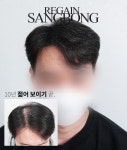 리게인프로젝트 상봉점