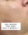 더마올가스킨