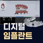 대구본플란트치과의원