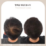 더채움 스칼프&뷰티