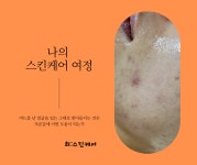 희 : 스킨케어