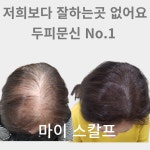 마이스칼프
