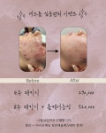 채움에스테틱