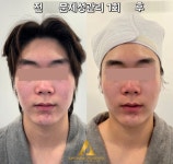 김포골든뷰티&어썸웰스파 | 어썸웰스파 피부관리