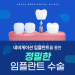 서울바로치과의원 수원 금곡동