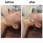새라스킨케어