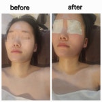 새라스킨케어