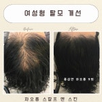 차오름 스칼프