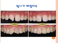 보스톤킹치과의원