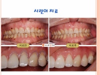 보스톤킹치과의원