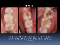 보스톤킹치과의원