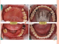 보스톤킹치과의원