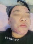 선피부관리&스킨바디두피